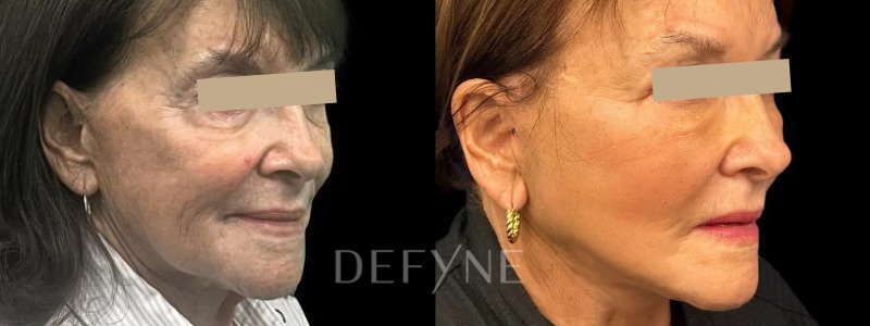 merged_image
