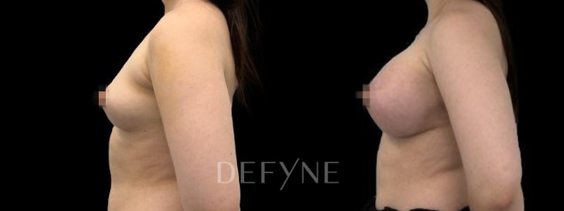 Patient #27276 Combined Image