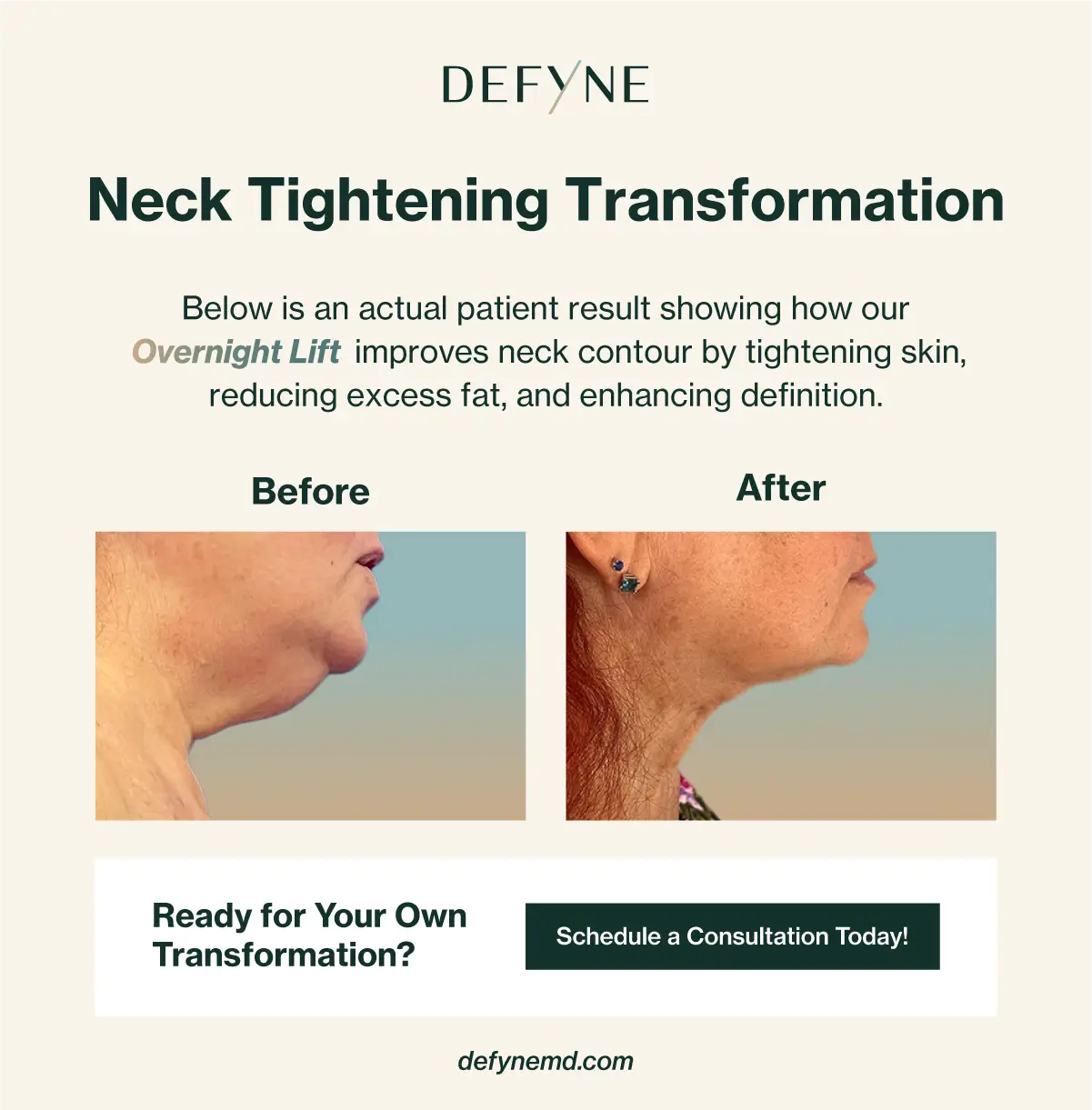 neck tightening transformation before and after