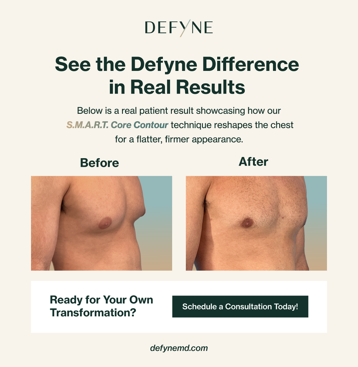 before and after treatment