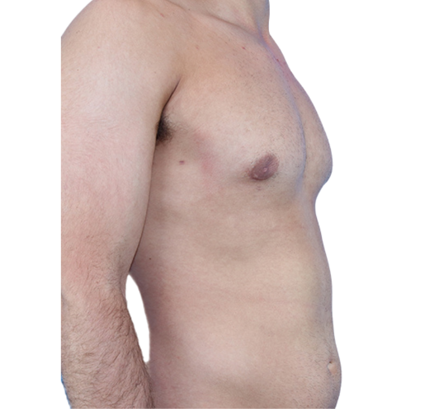 smart core contour after