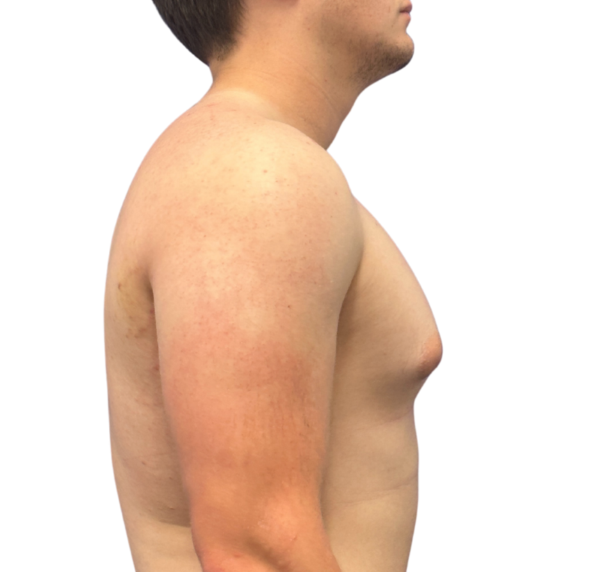 smart core contour before