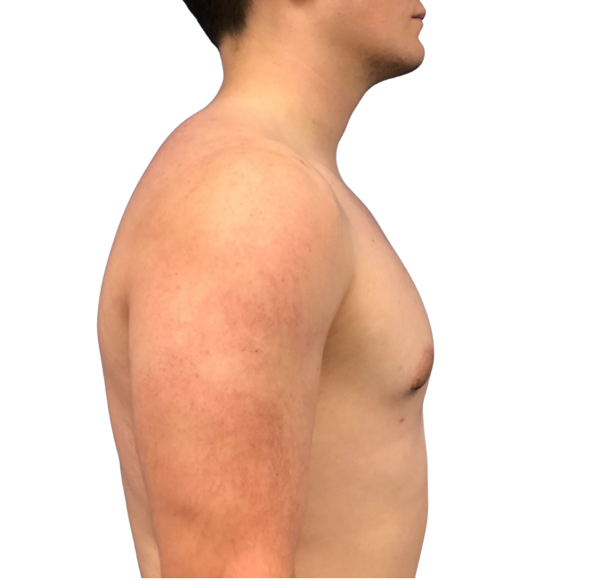 smart core contour after