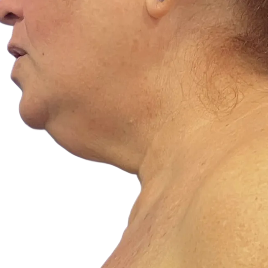 overnight lift before