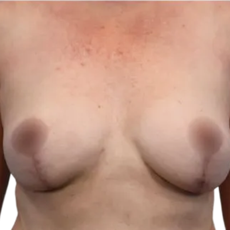 Case-2-After-1