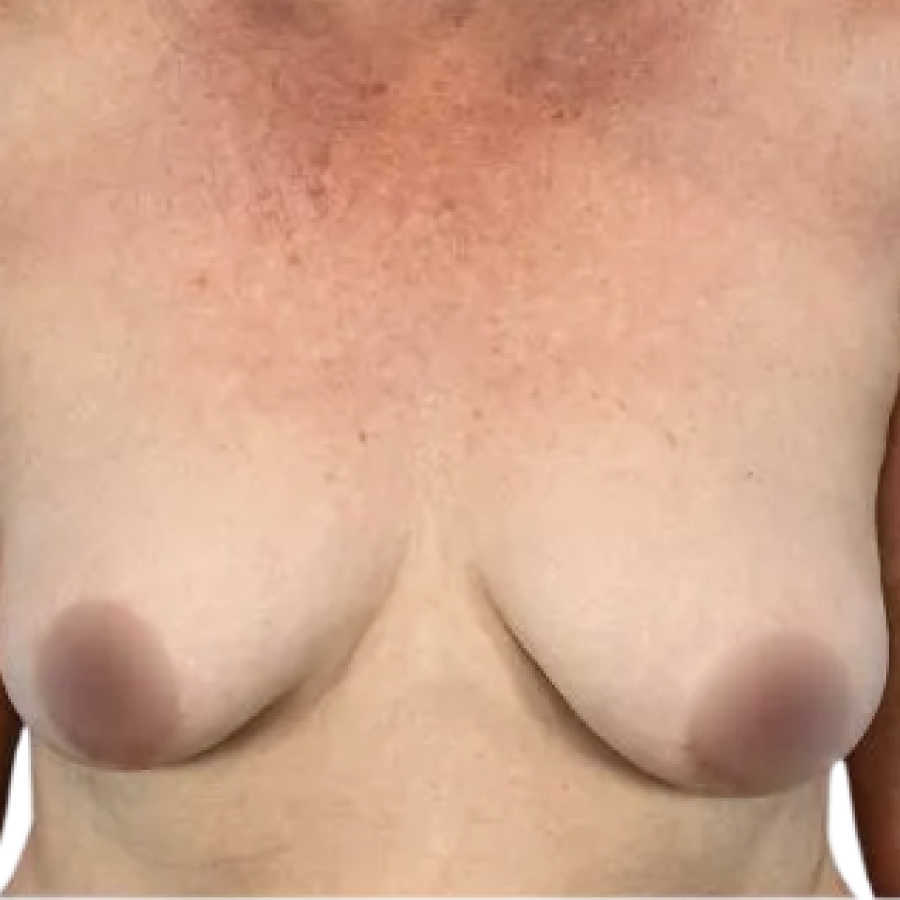 Case-2-Before-1