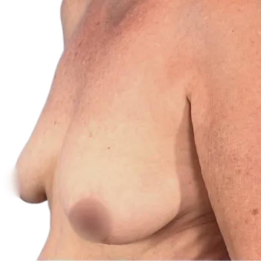 Case-2-Before-3