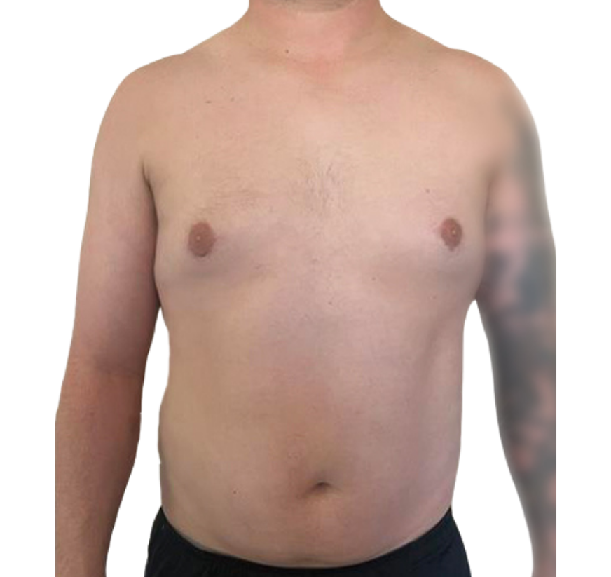 smart core contour after