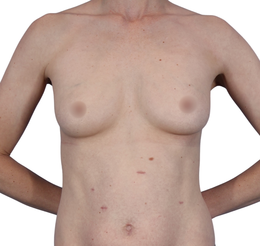 true shape before