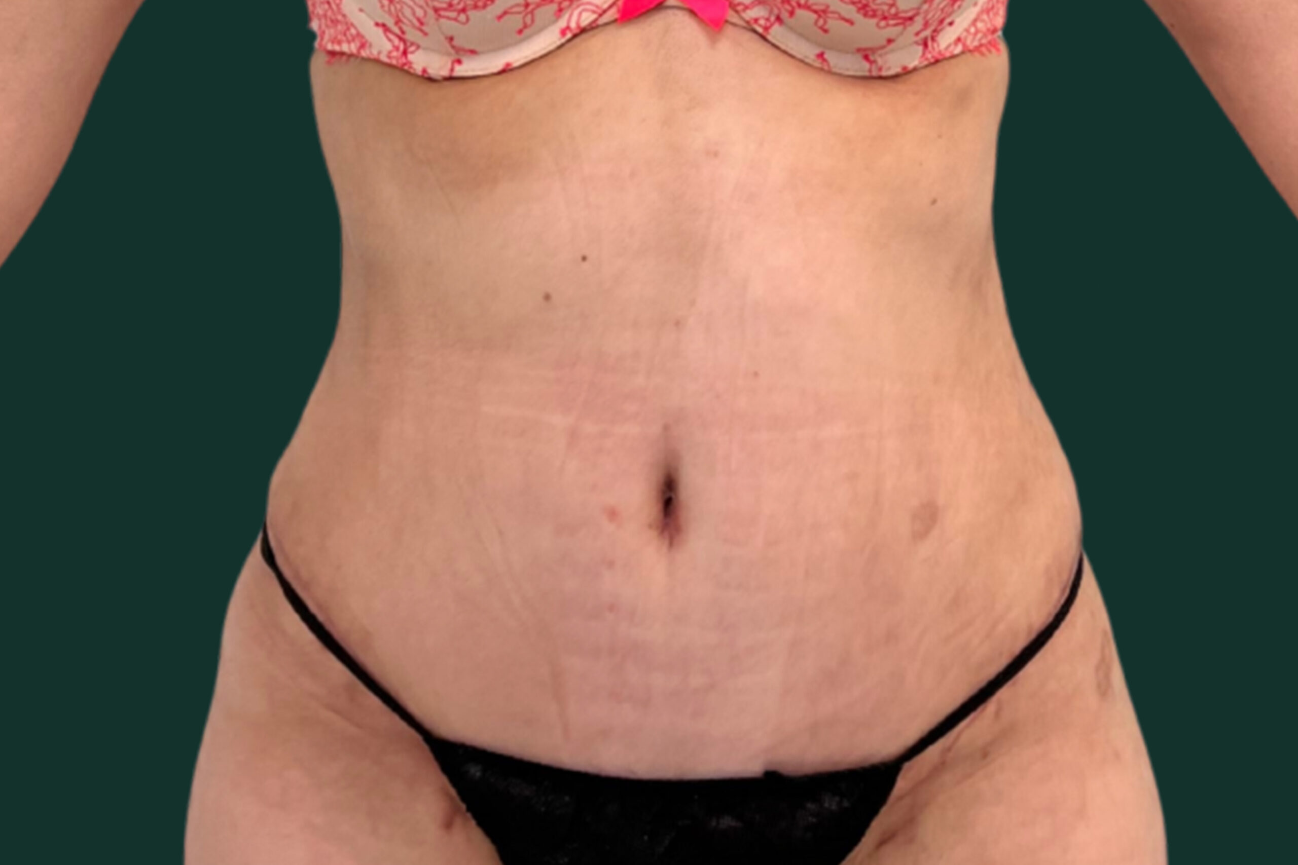 after-body-scaled