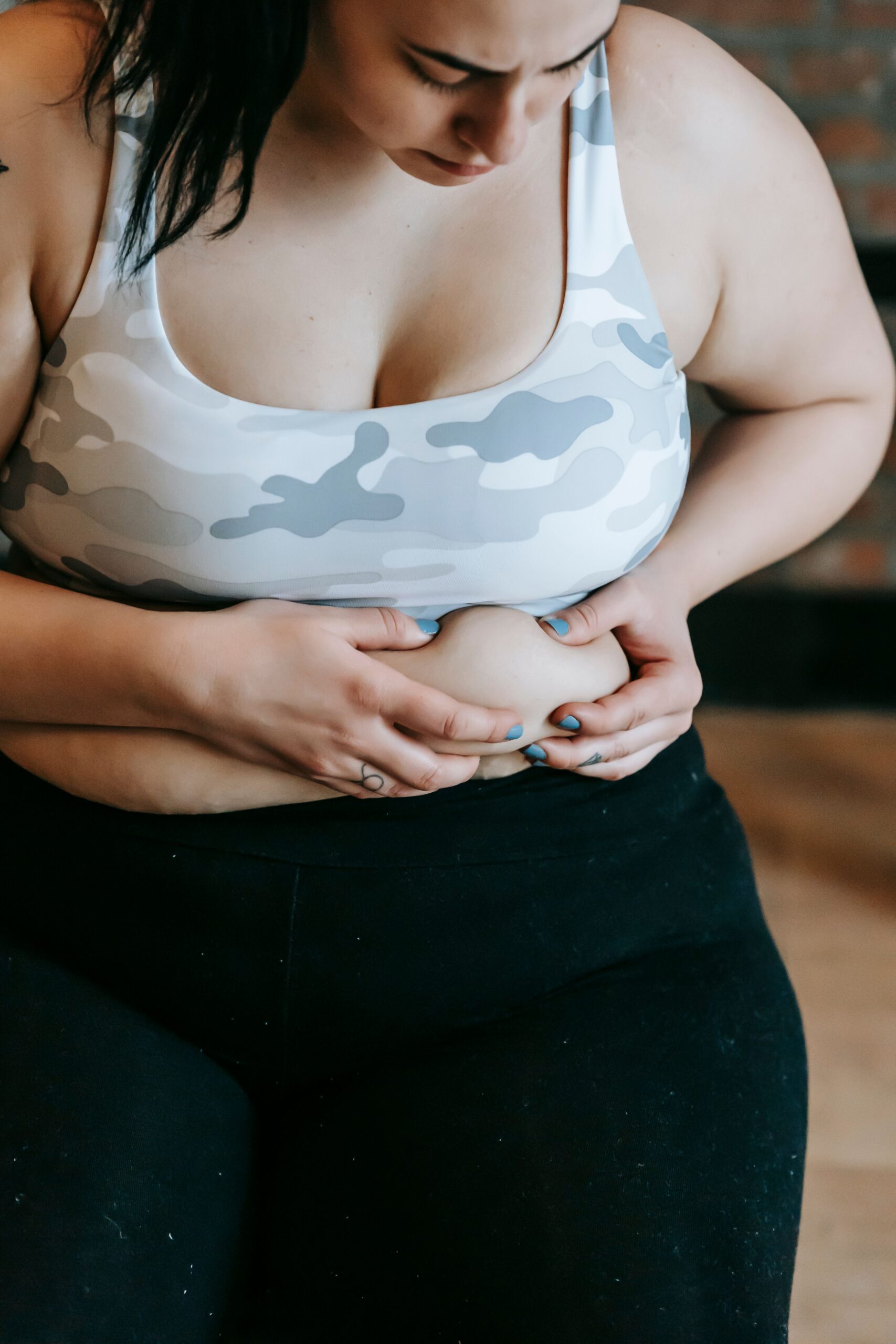 What is a Reverse Tummy Tuck?