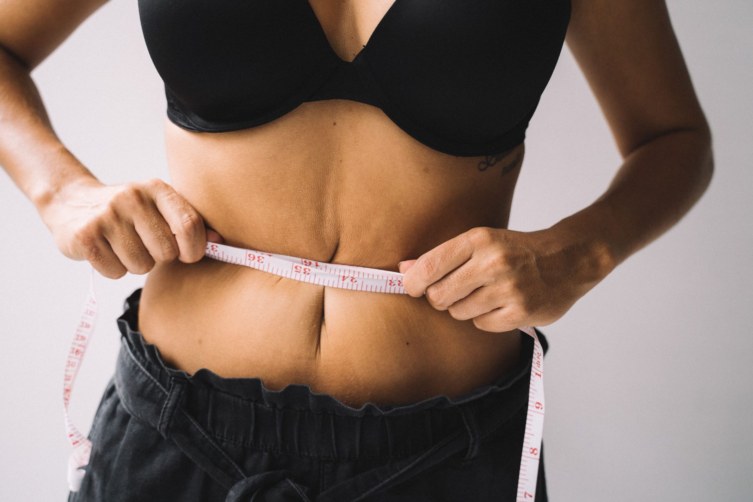 What is a Mini Tummy Tuck?