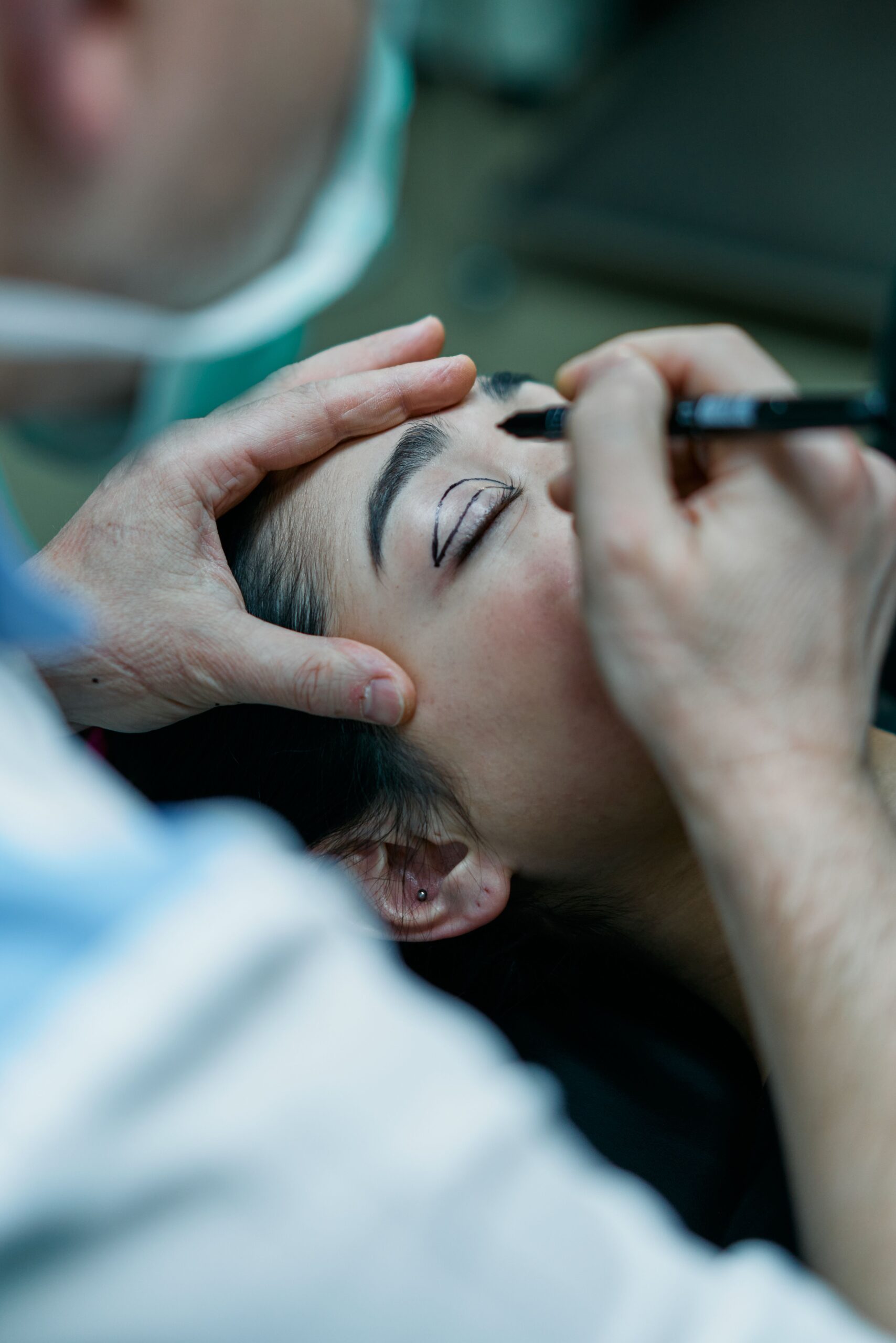 How Long Does Blepharoplasty Last?